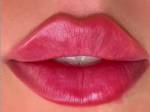 Filler labbra 